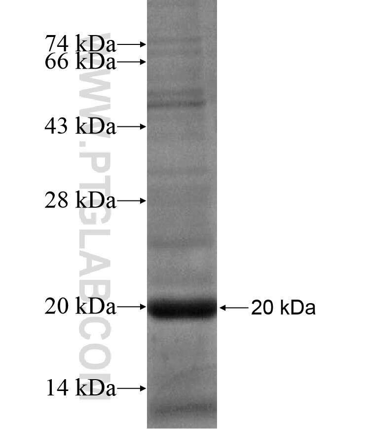ZNF268 fusion protein Ag17375 SDS-PAGE