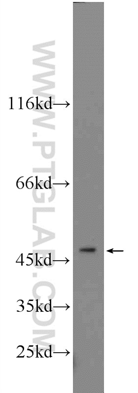 Western Blot (WB) analysis of mouse pancreas tissue using ZNF271 Polyclonal antibody (23799-1-AP)