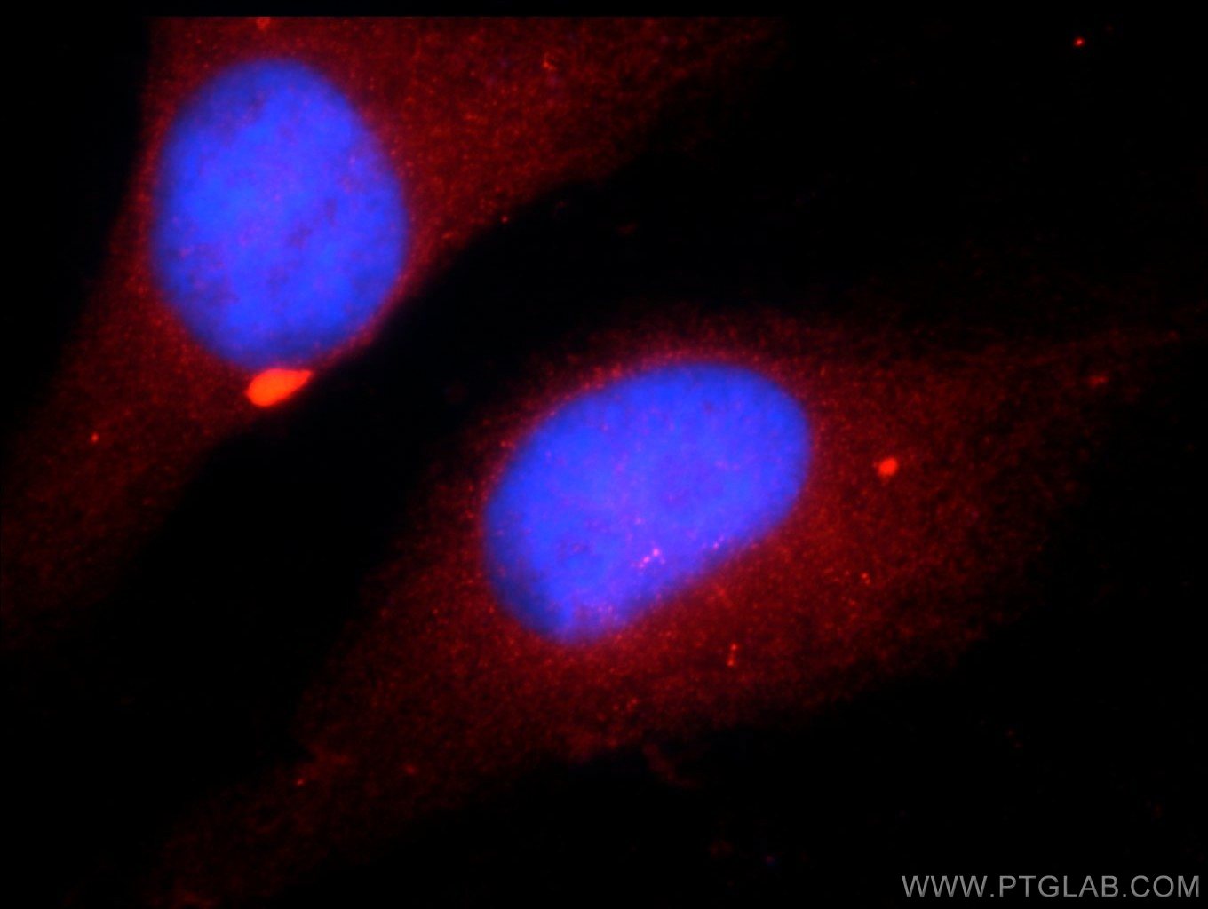 Immunofluorescence (IF) / fluorescent staining of HepG2 cells using ZNF277 Polyclonal antibody (25094-1-AP)