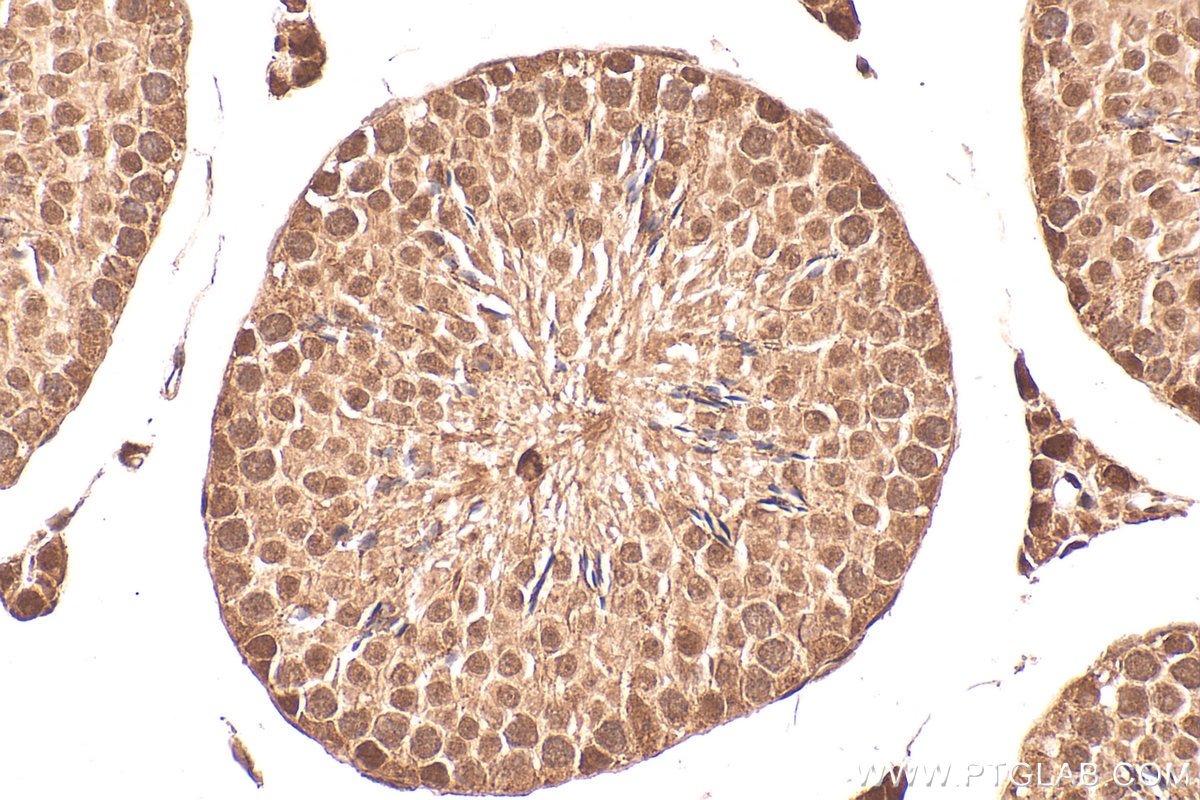 Immunohistochemistry (IHC) staining of mouse testis tissue using ZNF277 Polyclonal antibody (25094-1-AP)