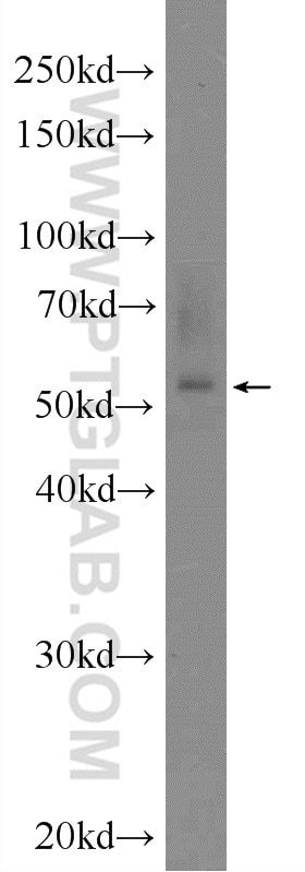 Western Blot (WB) analysis of Jurkat cells using ZNF277 Polyclonal antibody (25094-1-AP)