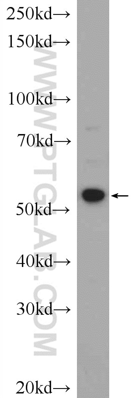 Western Blot (WB) analysis of PC-3 cells using ZNF277 Polyclonal antibody (25094-1-AP)