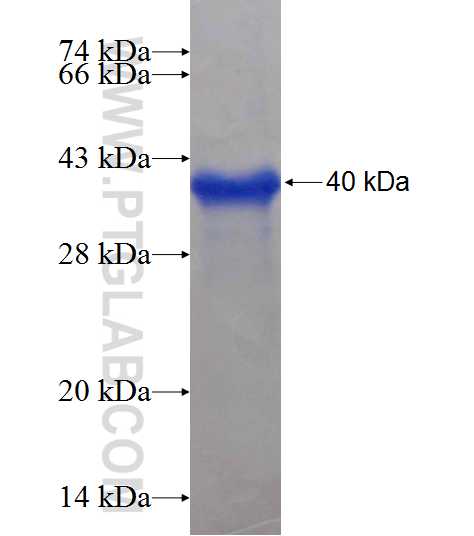 ZNF277 fusion protein Ag18979 SDS-PAGE