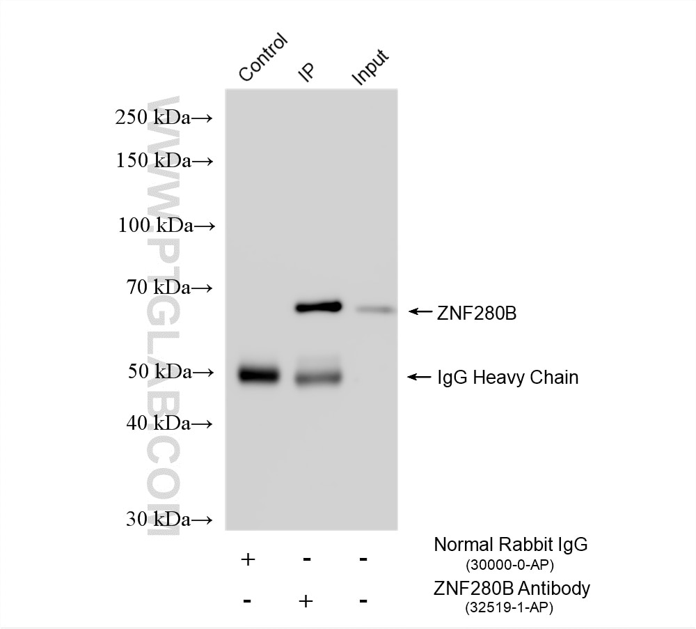 Immunoprecipitation (IP) experiment of K-562 cells using ZNF280B Polyclonal antibody (32519-1-AP)