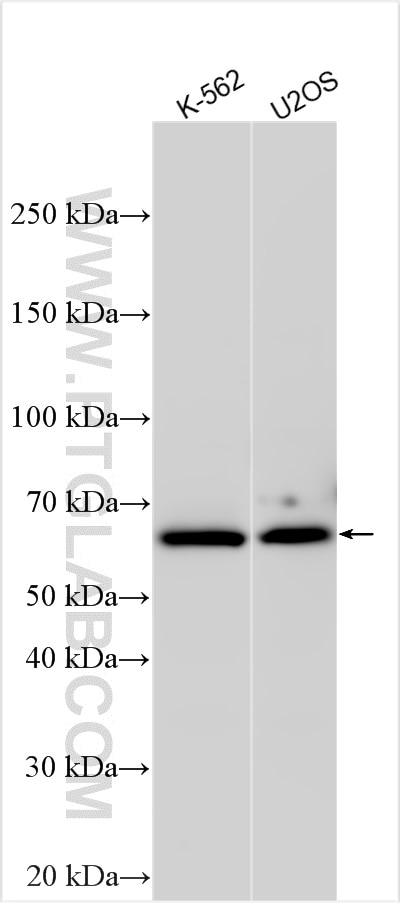ZNF280B