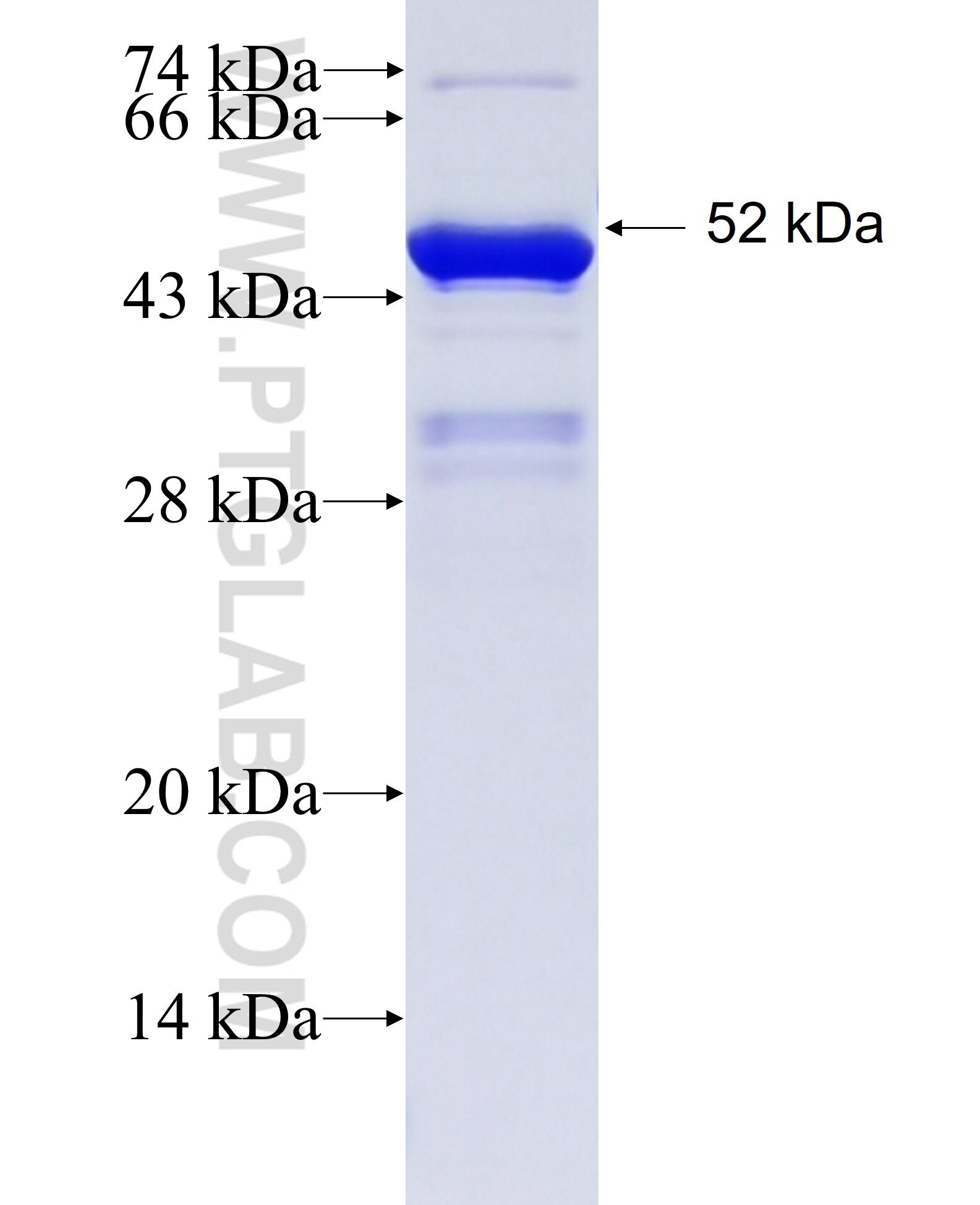 ZNF280B fusion protein Ag38544 SDS-PAGE