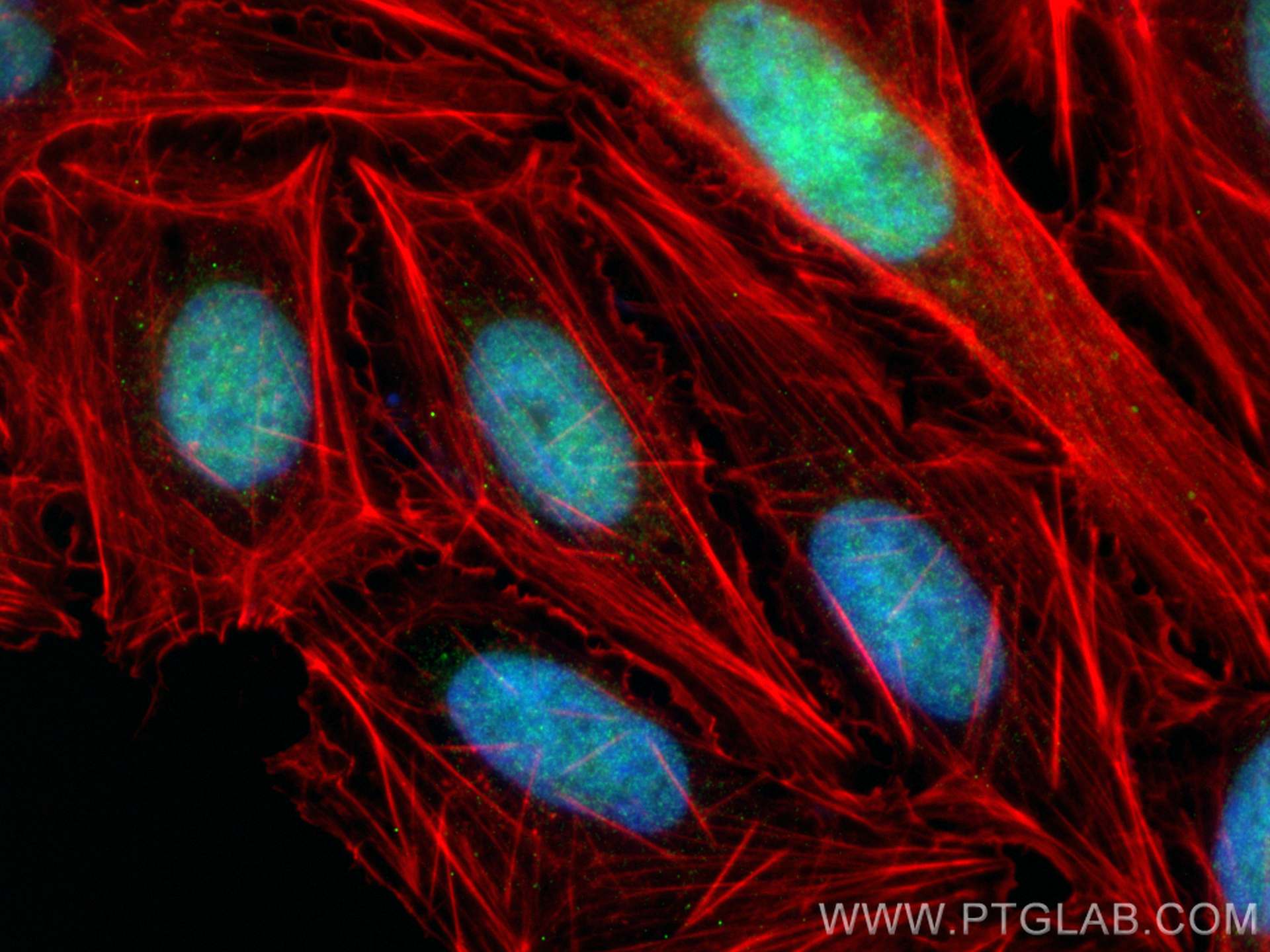 Immunofluorescence (IF) / fluorescent staining of U2OS cells using ZNF281 Polyclonal antibody (24088-1-AP)