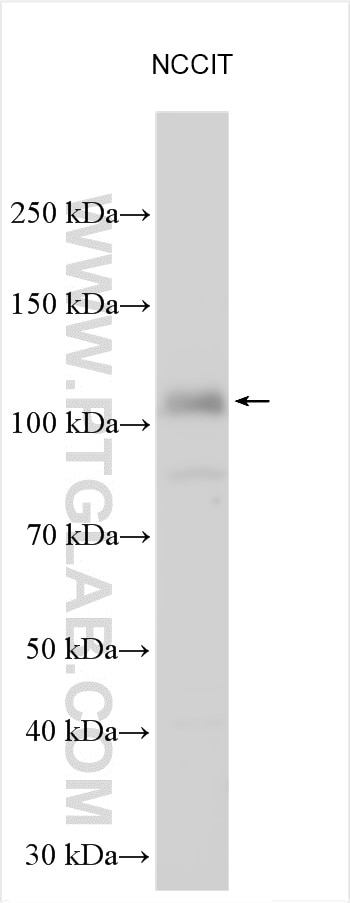 Western Blot (WB) analysis of various lysates using ZNF281 Polyclonal antibody (24088-1-AP)