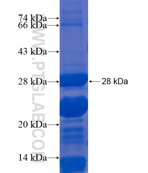 ZNF281 fusion protein Ag21355 SDS-PAGE