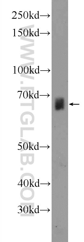 Western Blot (WB) analysis of mouse liver tissue using ZNF284 Polyclonal antibody (24681-1-AP)