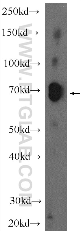 Western Blot (WB) analysis of mouse liver tissue using ZNF284 Polyclonal antibody (24681-1-AP)