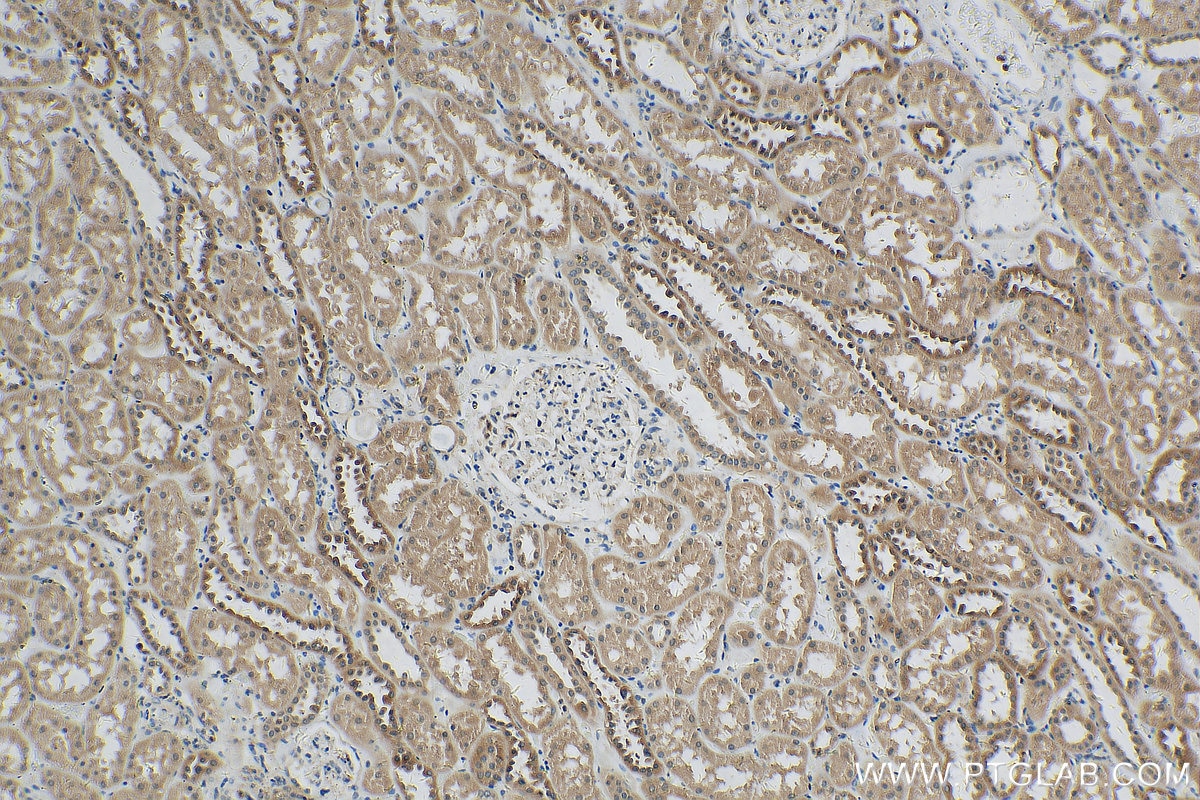 Immunohistochemistry (IHC) staining of human kidney tissue using ZNF287 Polyclonal antibody (22162-1-AP)