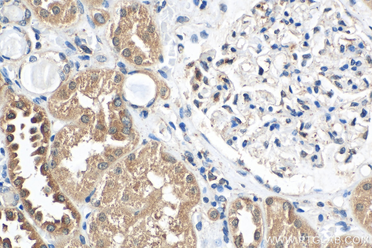 Immunohistochemistry (IHC) staining of human kidney tissue using ZNF287 Polyclonal antibody (22162-1-AP)