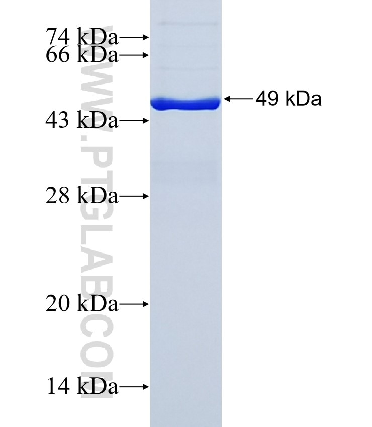 ZNF296 fusion protein Ag38129 SDS-PAGE ZNF296 fusion protein Ag38129 SDS-PAGE