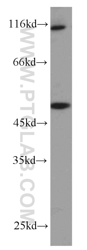 Western Blot (WB) analysis of mouse ovary tissue using ZNF3 Polyclonal antibody (16950-1-AP)