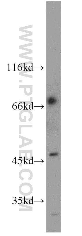 Western Blot (WB) analysis of mouse testis tissue using ZNF3 Polyclonal antibody (16950-1-AP)