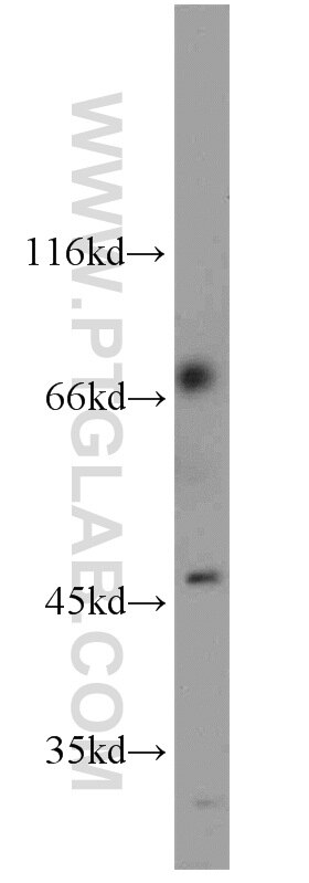 Western Blot (WB) analysis of mouse testis tissue using ZNF3 Polyclonal antibody (16950-1-AP)