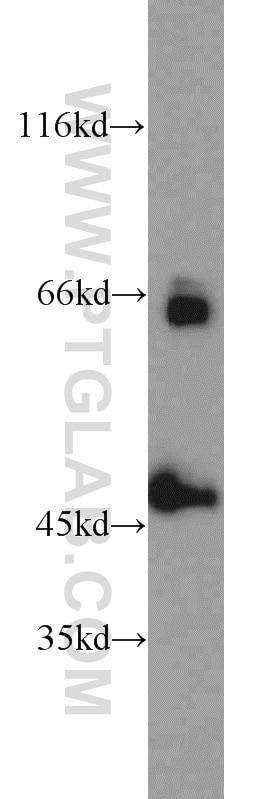 Western Blot (WB) analysis of A2780 cells using ZNF3 Polyclonal antibody (16950-1-AP)