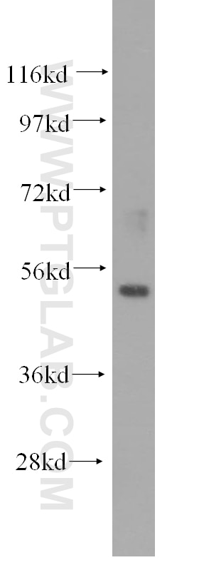 Western Blot (WB) analysis of mouse ovary tissue using ZNF3 Polyclonal antibody (16950-1-AP)