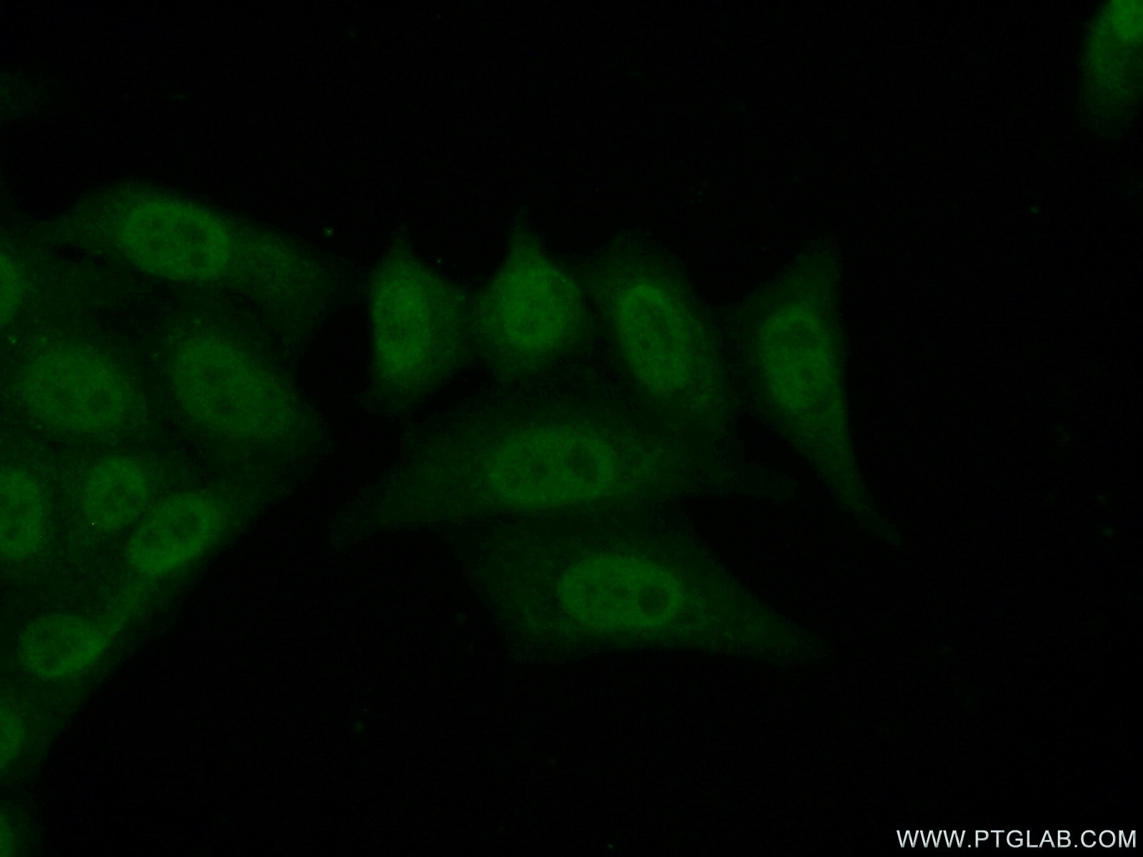 Immunofluorescence (IF) / fluorescent staining of HepG2 cells using ZNF30 Polyclonal antibody (24952-1-AP)