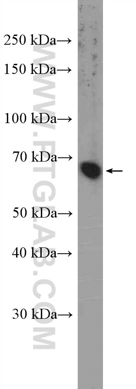 Western Blot (WB) analysis of HeLa cells using ZNF30 Polyclonal antibody (24952-1-AP)