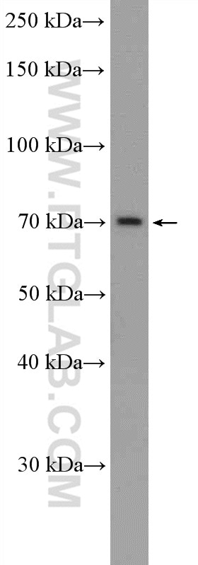 Western Blot (WB) analysis of HepG2 cells using ZNF30 Polyclonal antibody (24952-1-AP)