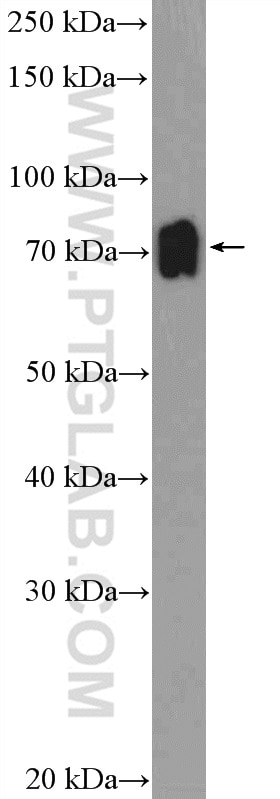 Western Blot (WB) analysis of mouse spleen tissue using ZNF30 Polyclonal antibody (24952-1-AP)
