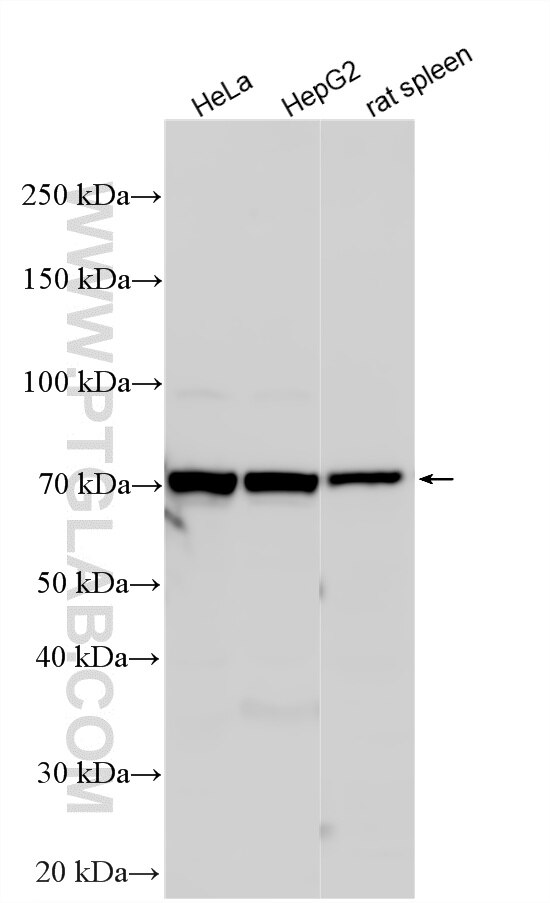 Western Blot (WB) analysis of various lysates using ZNF30 Polyclonal antibody (24952-1-AP)