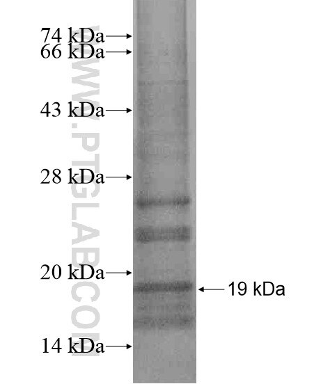 ZNF30 fusion protein Ag20281 SDS-PAGE