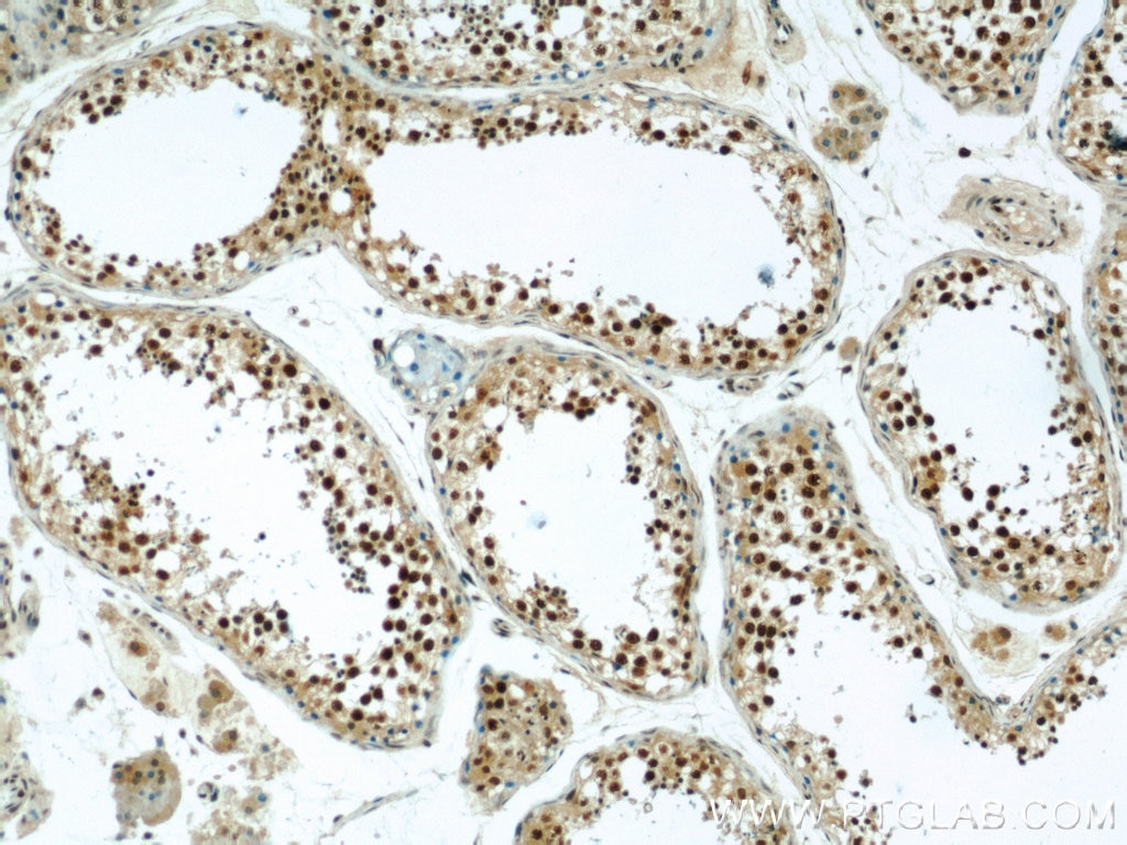Immunohistochemistry (IHC) staining of human testis tissue using ZNF311 Polyclonal antibody (23243-1-AP)