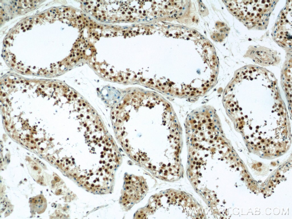 IHC staining of human testis using 23243-1-AP