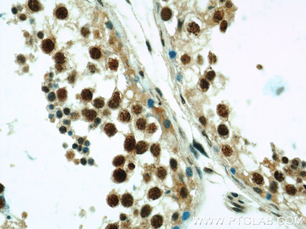 Immunohistochemistry (IHC) staining of human testis tissue using ZNF311 Polyclonal antibody (23243-1-AP)