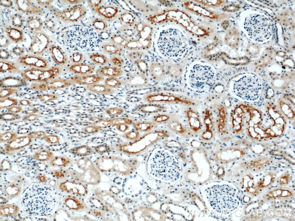 Immunohistochemistry (IHC) staining of human kidney tissue using ZNF311 Polyclonal antibody (23243-1-AP)