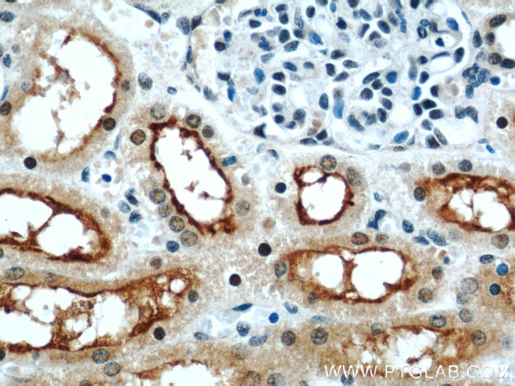 Immunohistochemistry (IHC) staining of human kidney tissue using ZNF311 Polyclonal antibody (23243-1-AP)