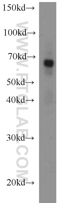 WB analysis of HL-60 using 23243-1-AP