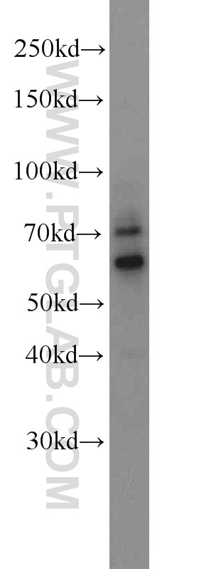 Western Blot (WB) analysis of HL-60 cells using ZNF311 Polyclonal antibody (23243-1-AP)