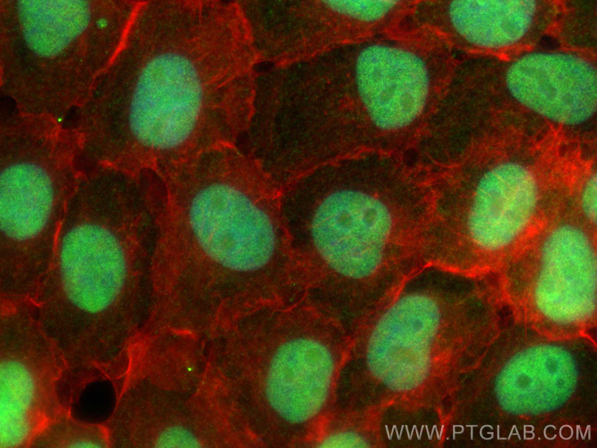IF Staining of A431 using 26035-1-AP Immunofluorescence (IF) / fluorescent staining of A431 cells using ZNF318 Polyclonal antibody (26035-1-AP)