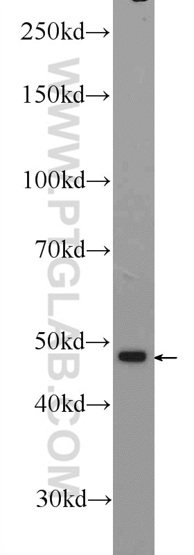 Western Blot (WB) analysis of mouse kidney tissue using ZNF323 Polyclonal antibody (25593-1-AP)