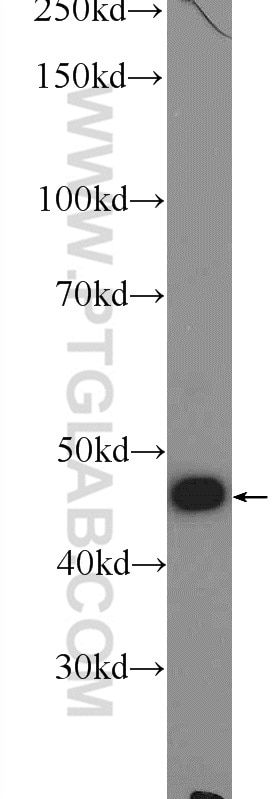 Western Blot (WB) analysis of mouse kidney tissue using ZNF323 Polyclonal antibody (25593-1-AP)