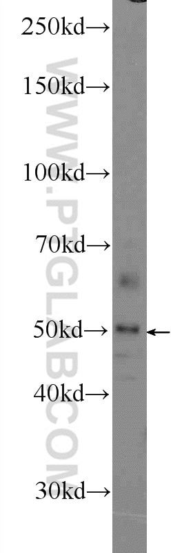 Western Blot (WB) analysis of mouse lung tissue using ZNF323 Polyclonal antibody (25593-1-AP)