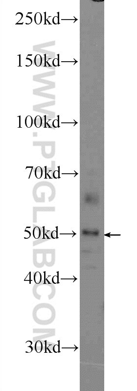 WB analysis of mouse lung using 25593-1-AP