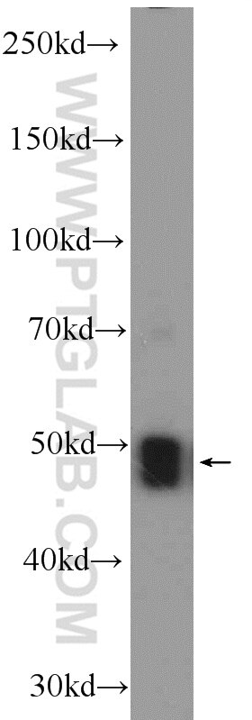 Western Blot (WB) analysis of mouse kidney tissue using ZNF323 Polyclonal antibody (25593-1-AP)