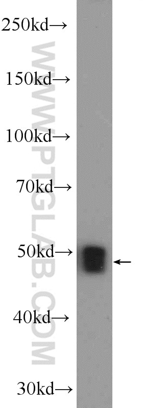 Western Blot (WB) analysis of mouse kidney tissue using ZNF323 Polyclonal antibody (25593-1-AP)