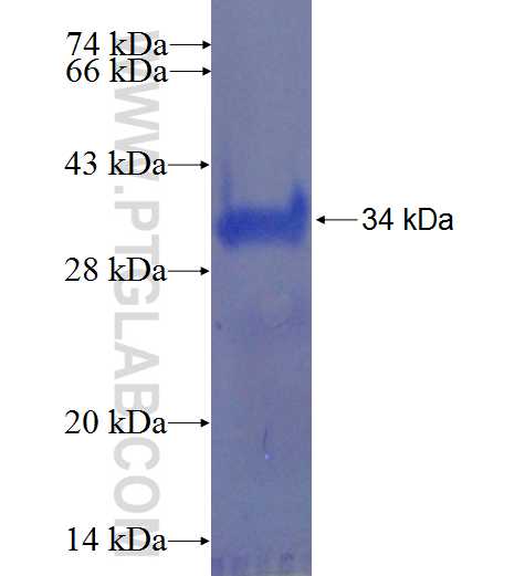 ZNF323 fusion protein Ag22405 SDS-PAGE