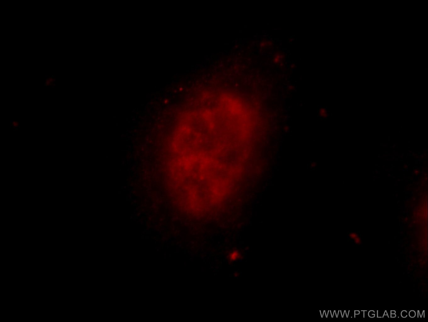 Immunofluorescence (IF) / fluorescent staining of HeLa cells using ZNF326 Polyclonal antibody (25147-1-AP)