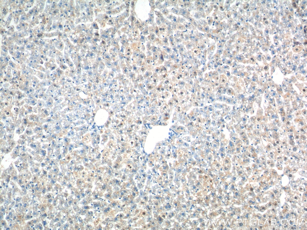 Immunohistochemistry (IHC) staining of mouse liver tissue using ZNF326 Polyclonal antibody (25147-1-AP)