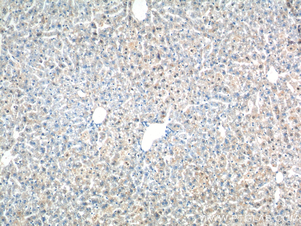 Immunohistochemistry (IHC) staining of mouse liver tissue using ZNF326 Polyclonal antibody (25147-1-AP)