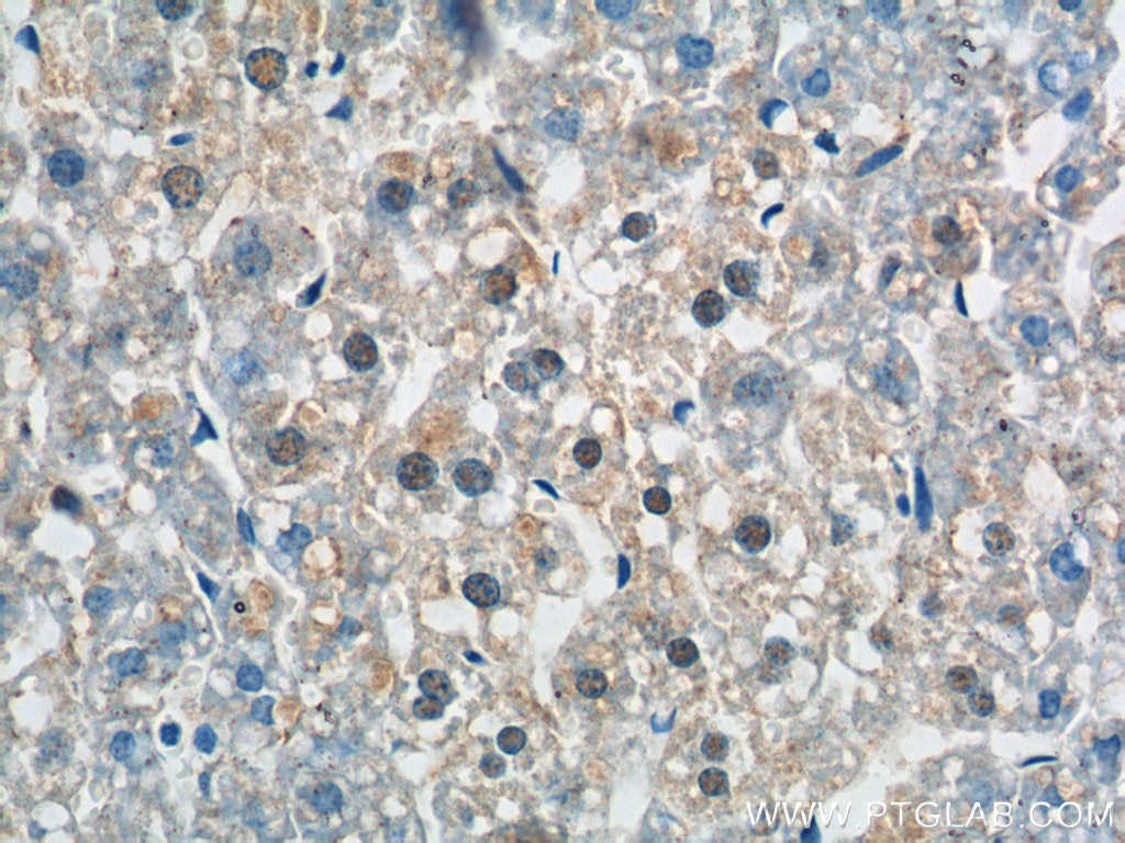 Immunohistochemistry (IHC) staining of mouse liver tissue using ZNF326 Polyclonal antibody (25147-1-AP)