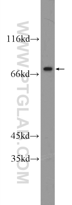 Western Blot (WB) analysis of HeLa cells using ZNF326 Polyclonal antibody (25147-1-AP)