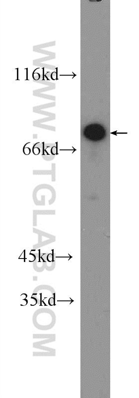 Western Blot (WB) analysis of Jurkat cells using ZNF326 Polyclonal antibody (25147-1-AP)
